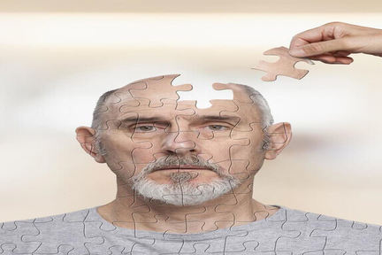 شناسایی ۳۲ پروتئین که ریسک ابتلا به آلزایمر را نشان می دهد